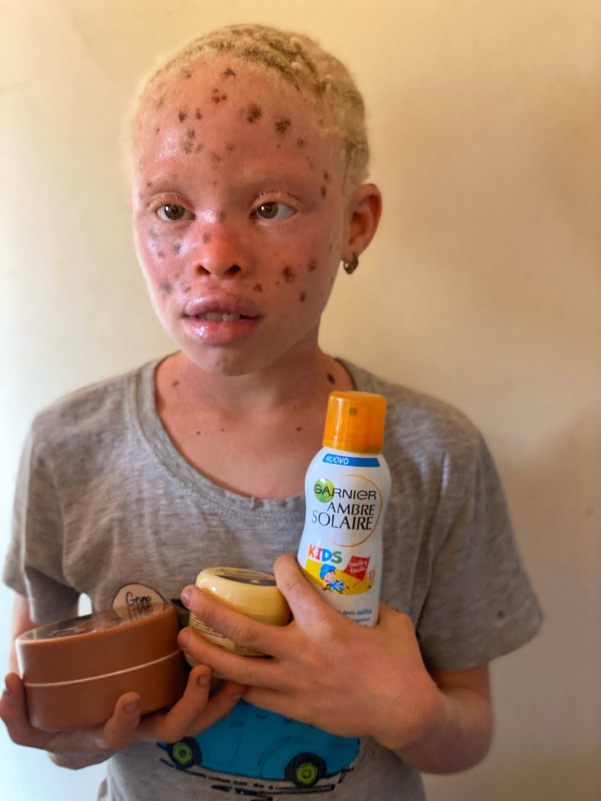 1. Santé et Protection